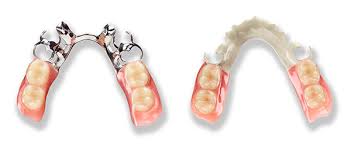 removable-denture