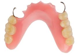 removable-denture